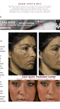 Mobile Screenshot of darkspotsnyc.net