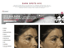 Tablet Screenshot of darkspotsnyc.com